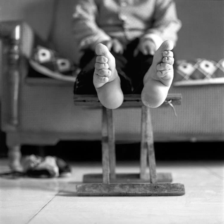 رسم عجیب کوچک کردن پای زنان؛ زنانی با کوچک‌ترین پاهای دنیا!/ عکس