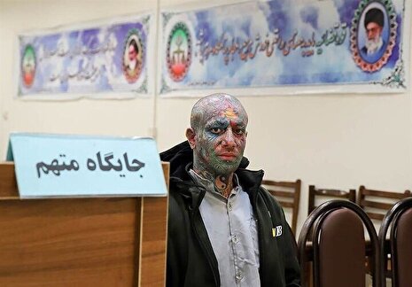 چرا تتلو خودکشی کرد؟ / آخرین خبرها از وضعیت جسمانی او